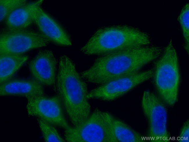 Cytokeratin 18 Antibody in Immunocytochemistry (ICC/IF)