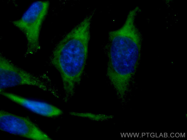 CYB5R3 Antibody in Immunocytochemistry (ICC/IF)