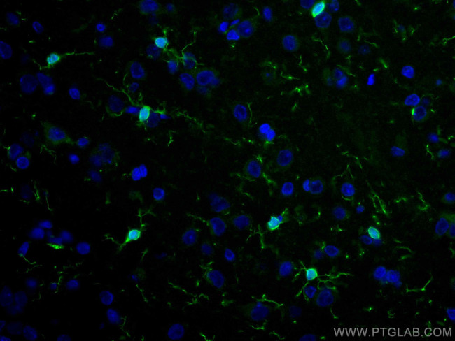 IBA1 Antibody in Immunohistochemistry (Paraffin) (IHC (P))