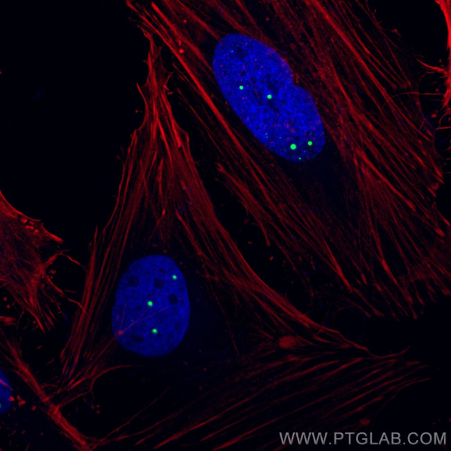Coilin Antibody in Immunocytochemistry (ICC/IF)