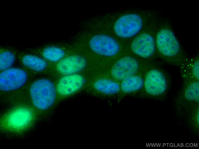 CDK4 Antibody in Immunocytochemistry (ICC/IF)