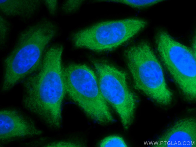 ENO1 Antibody in Immunocytochemistry (ICC/IF)