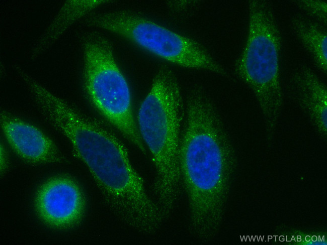 PDI Antibody in Immunocytochemistry (ICC/IF)