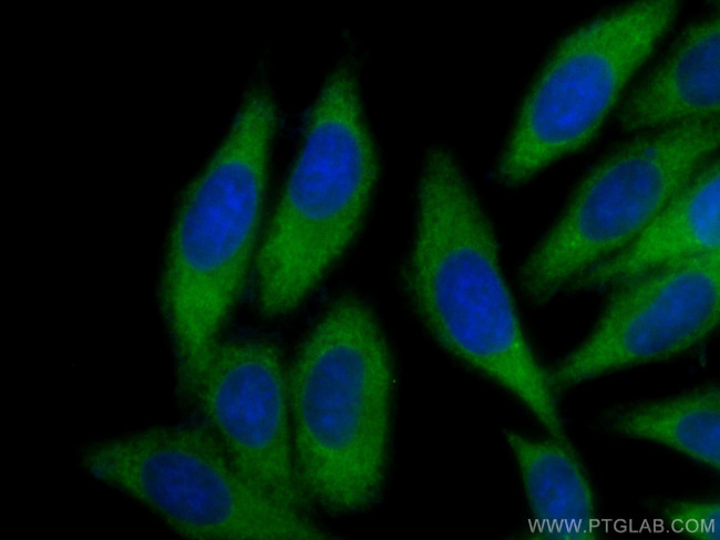 IRF3 Antibody in Immunocytochemistry (ICC/IF)
