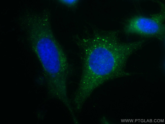 IFITM3 Antibody in Immunocytochemistry (ICC/IF)