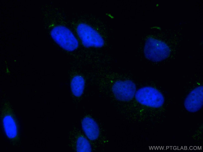 IFT81 Antibody in Immunocytochemistry (ICC/IF)