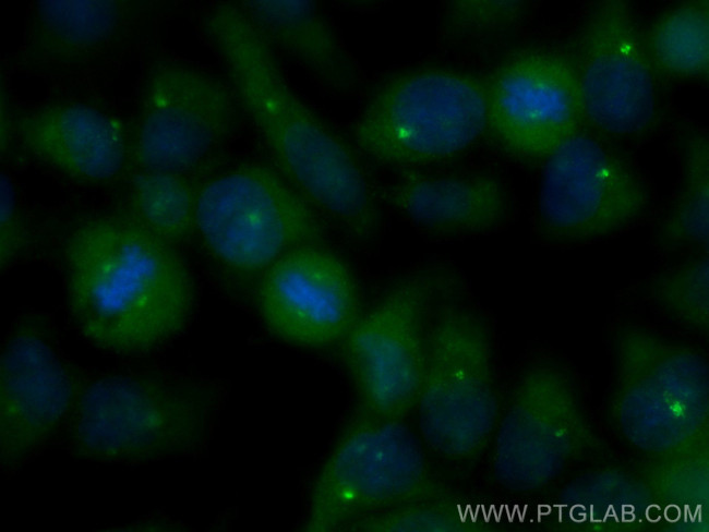 CSPP1 Antibody in Immunocytochemistry (ICC/IF)