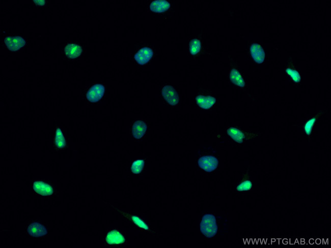 Cyclin E2 Antibody in Immunocytochemistry (ICC/IF)