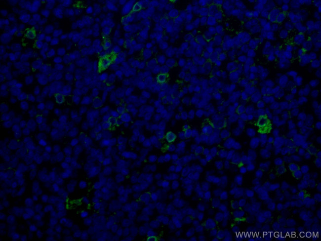 TIMD4 Antibody in Immunohistochemistry (Paraffin) (IHC (P))