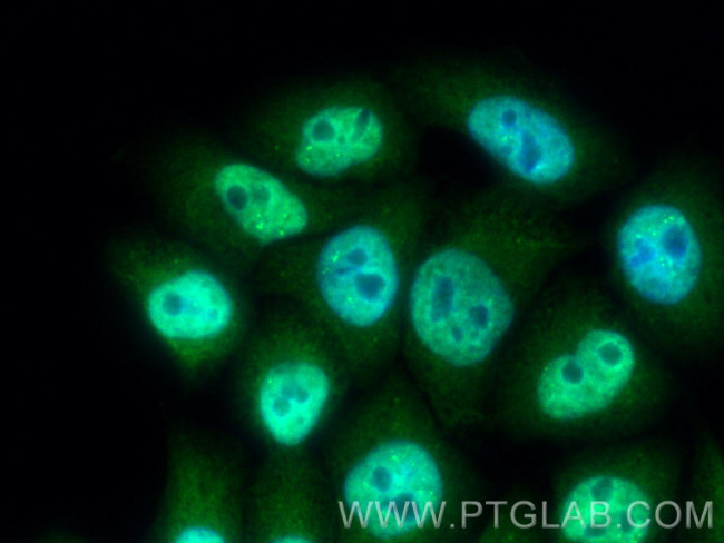 TIA1 Antibody in Immunocytochemistry (ICC/IF)