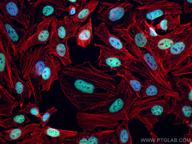 CREST Antibody in Immunocytochemistry (ICC/IF)