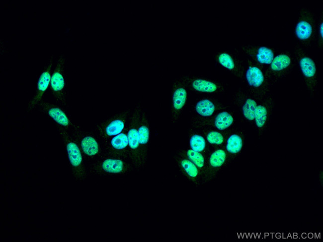 SAMHD1 Antibody in Immunocytochemistry (ICC/IF)