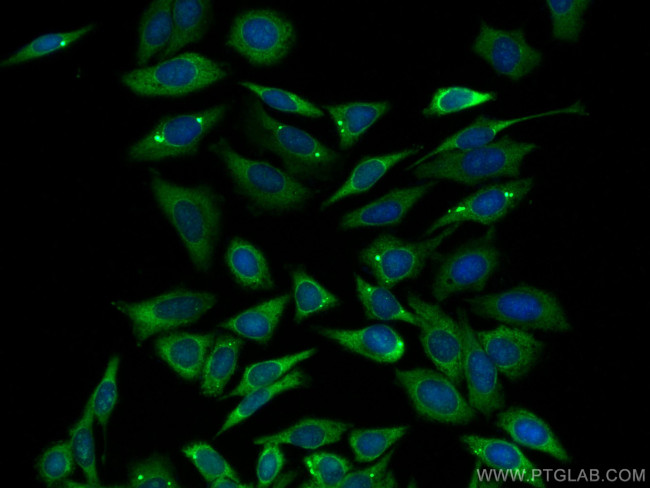 MEK6 Antibody in Immunocytochemistry (ICC/IF)