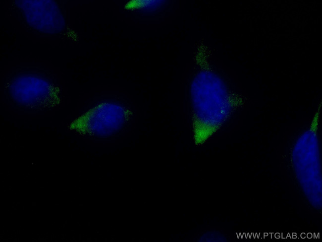 CP110 Antibody in Immunocytochemistry (ICC/IF)