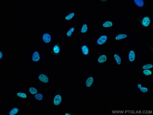 TDP-43 Antibody in Immunocytochemistry (ICC/IF)