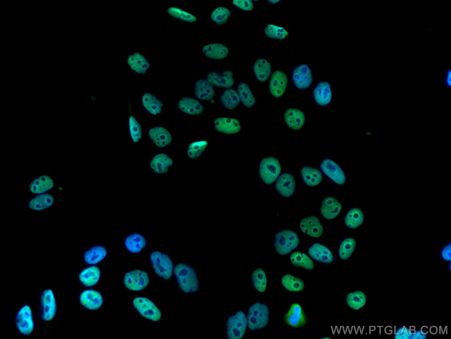 HDAC2 Antibody in Immunocytochemistry (ICC/IF)