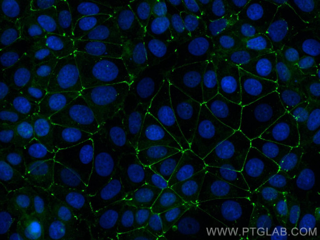 Occludin Antibody in Immunocytochemistry (ICC/IF)