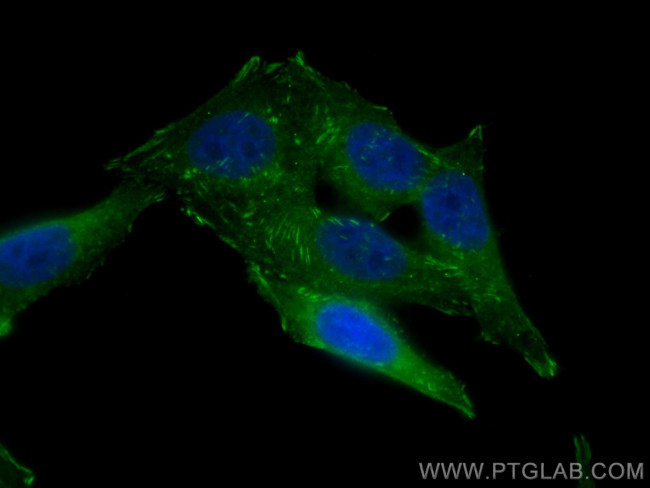 VASP Antibody in Immunocytochemistry (ICC/IF)