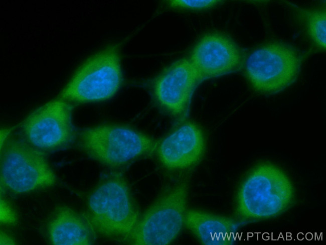 Beta-2-Microglobulin Antibody in Immunocytochemistry (ICC/IF)