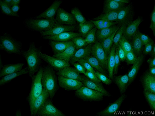 YAP1 Antibody in Immunocytochemistry (ICC/IF)