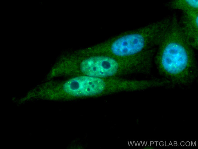 PFKFB3 Antibody in Immunocytochemistry (ICC/IF)