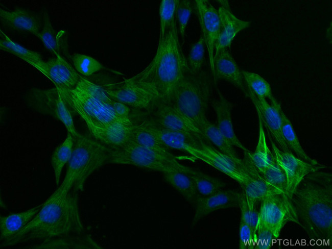 Calponin Antibody in Immunocytochemistry (ICC/IF)