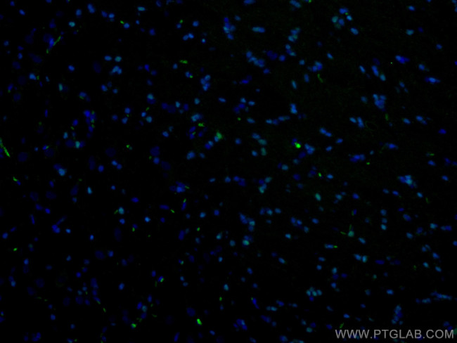 OLIG2 Antibody in Immunohistochemistry (Paraffin) (IHC (P))
