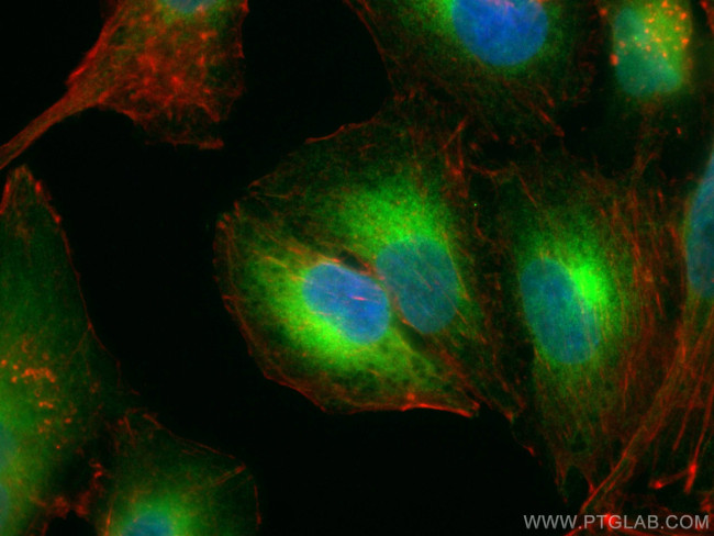 REEP5 Antibody in Immunocytochemistry (ICC/IF)