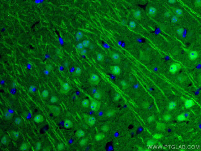UCHL1/PGP9.5 Antibody in Immunohistochemistry (Paraffin) (IHC (P))