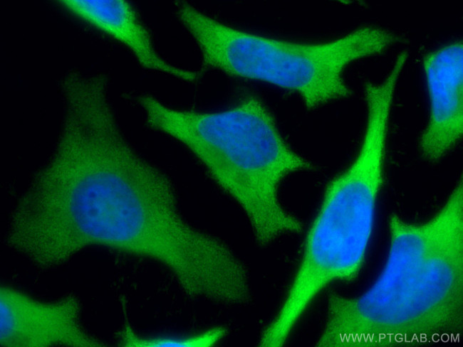 LDHB Antibody in Immunocytochemistry (ICC/IF)