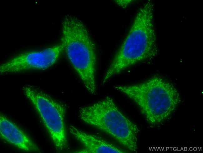GRP75 Antibody in Immunocytochemistry (ICC/IF)