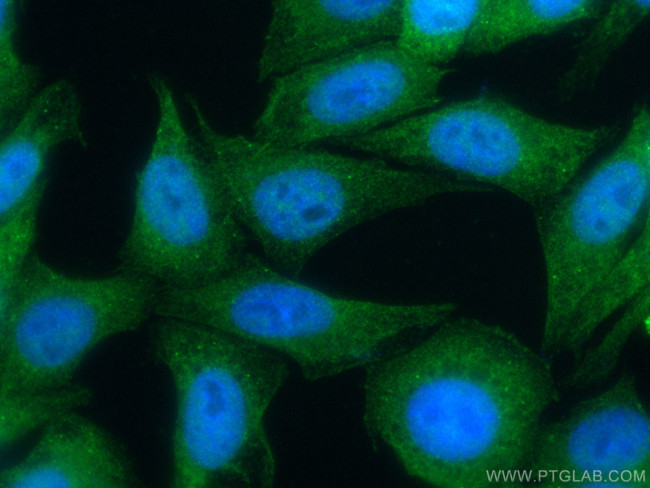 RBPMS Antibody in Immunocytochemistry (ICC/IF)