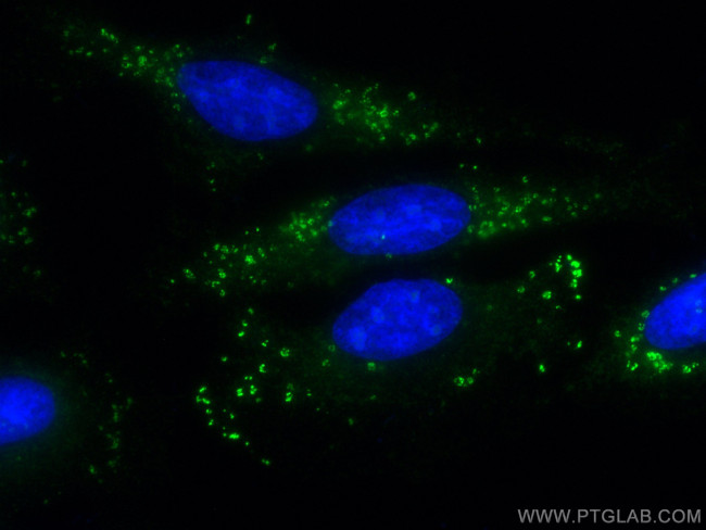 ADRP/Perilipin 2 Antibody in Immunocytochemistry (ICC/IF)