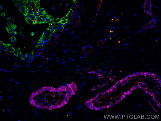 Cytokeratin 7 Antibody in Immunohistochemistry (Paraffin) (IHC (P))