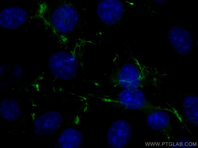 Fibronectin Antibody in Immunocytochemistry (ICC/IF)