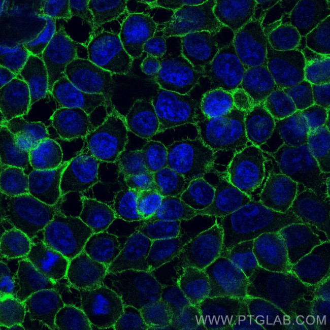 CD44 Antibody in Immunocytochemistry (ICC/IF)