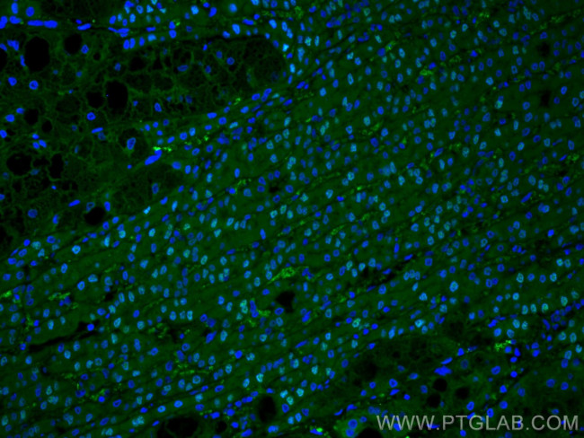 ARG1 Antibody in Immunohistochemistry (Paraffin) (IHC (P))