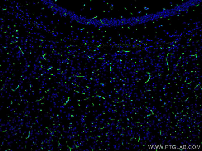 Aquaporin 4 Antibody in Immunohistochemistry (Paraffin) (IHC (P))