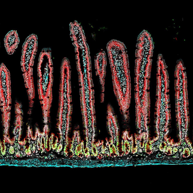 Desmin Antibody in Immunohistochemistry (Paraffin) (IHC (P))