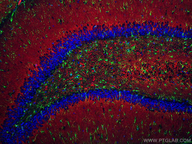 GFAP Antibody in Immunohistochemistry (Paraffin) (IHC (P))