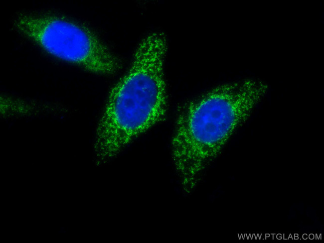 MFF Antibody in Immunocytochemistry (ICC/IF)