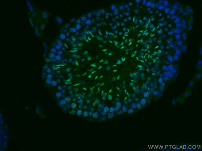 TNP1 Antibody in Immunohistochemistry (Paraffin) (IHC (P))