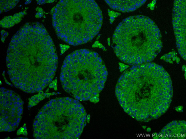 IFT140 Antibody in Immunohistochemistry (Paraffin) (IHC (P))