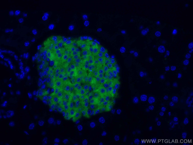 Synaptophysin Antibody in Immunohistochemistry (Paraffin) (IHC (P))