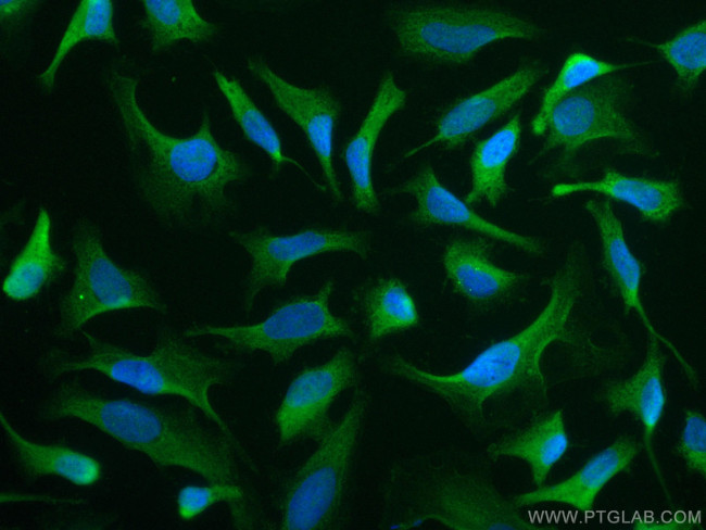 iNOS Antibody in Immunocytochemistry (ICC/IF)
