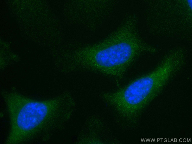 VEGFA Antibody in Immunocytochemistry (ICC/IF)