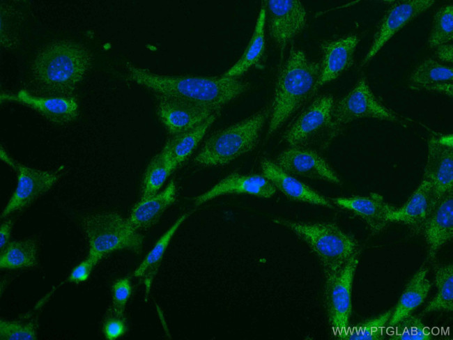 Caspase 3/p17/p19 Antibody in Immunocytochemistry (ICC/IF)