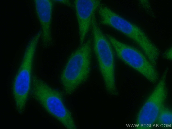 INF2 Antibody in Immunocytochemistry (ICC/IF)