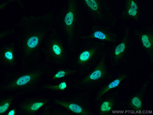 PI3 Kinase p110 Beta Antibody in Immunocytochemistry (ICC/IF)
