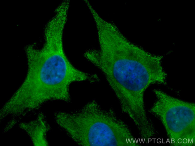 ROCK1 Antibody in Immunocytochemistry (ICC/IF)